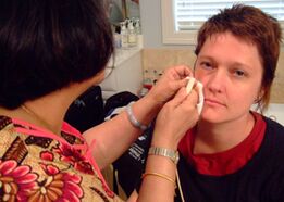 Yra farmacijos produktų, skirtų kovoti su karpomis ant veido